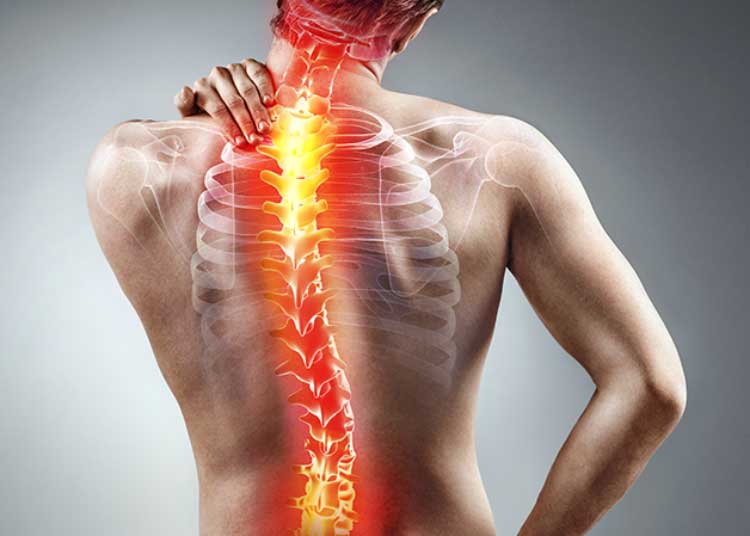 ¿Cómo funciona la descompresión espinal?